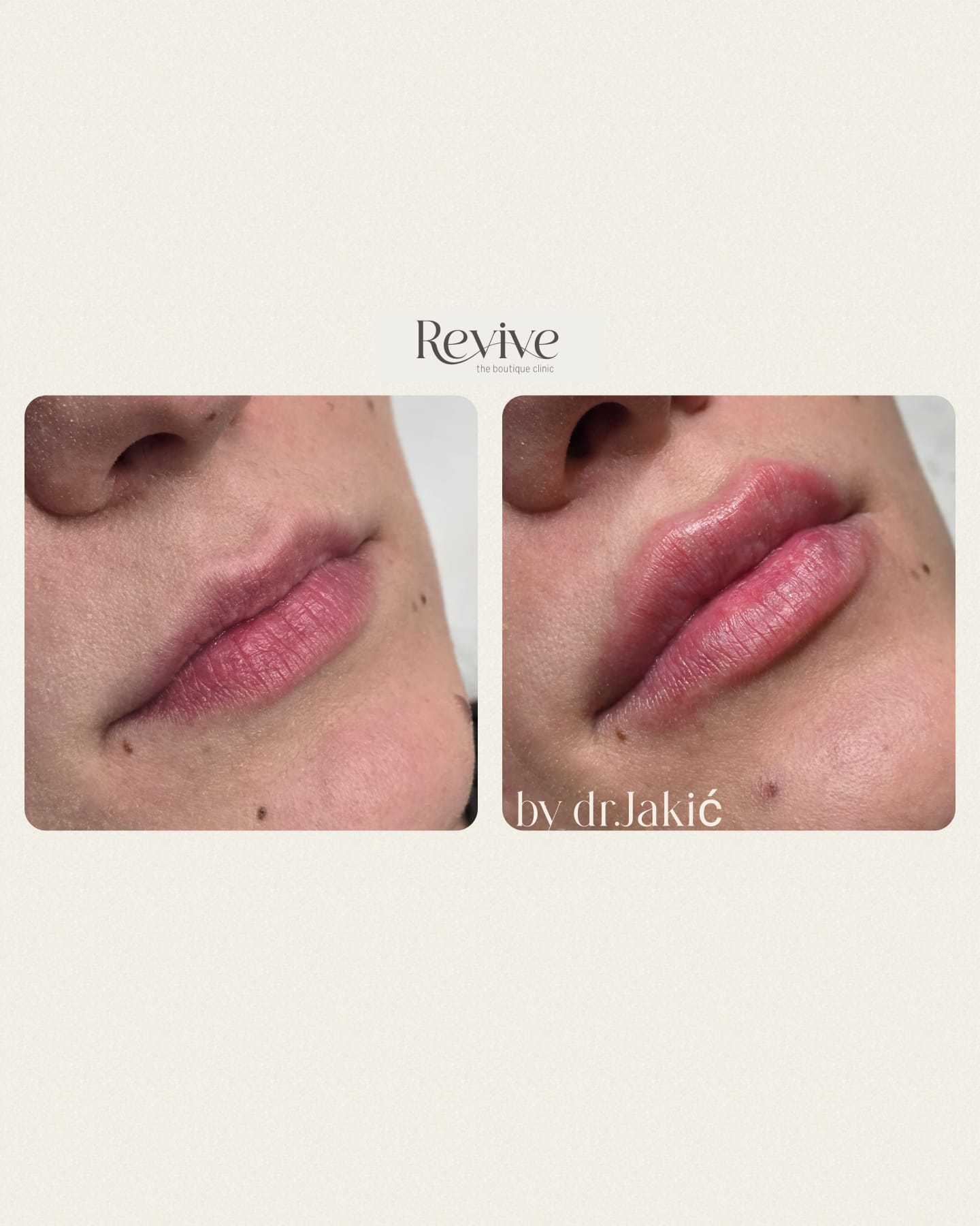 WhatsApp Image 2025-01-29 at 16.07.06_3530d5d6