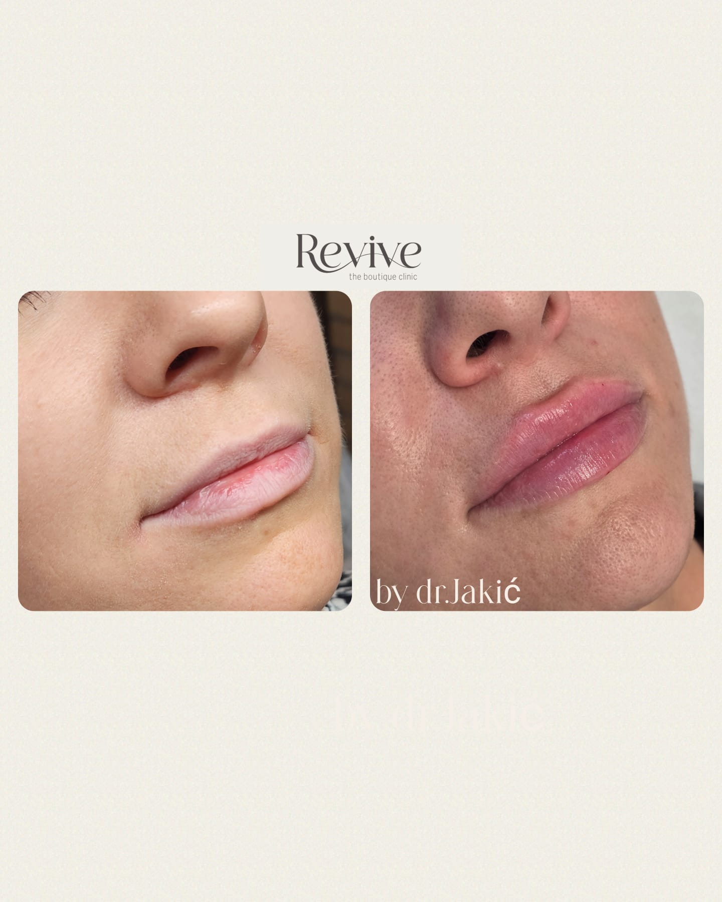 WhatsApp Image 2025-01-29 at 16.07.06_a04f1aeb